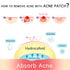 (BUY 1 GET 2) AUQUEST - Invisible Zit Patch